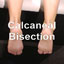 Calcaneal Bisection